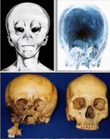 Click image for larger version

Name:	starchild-skull-pictures[1].jpg
Views:	46
Size:	45.5 KB
ID:	971097